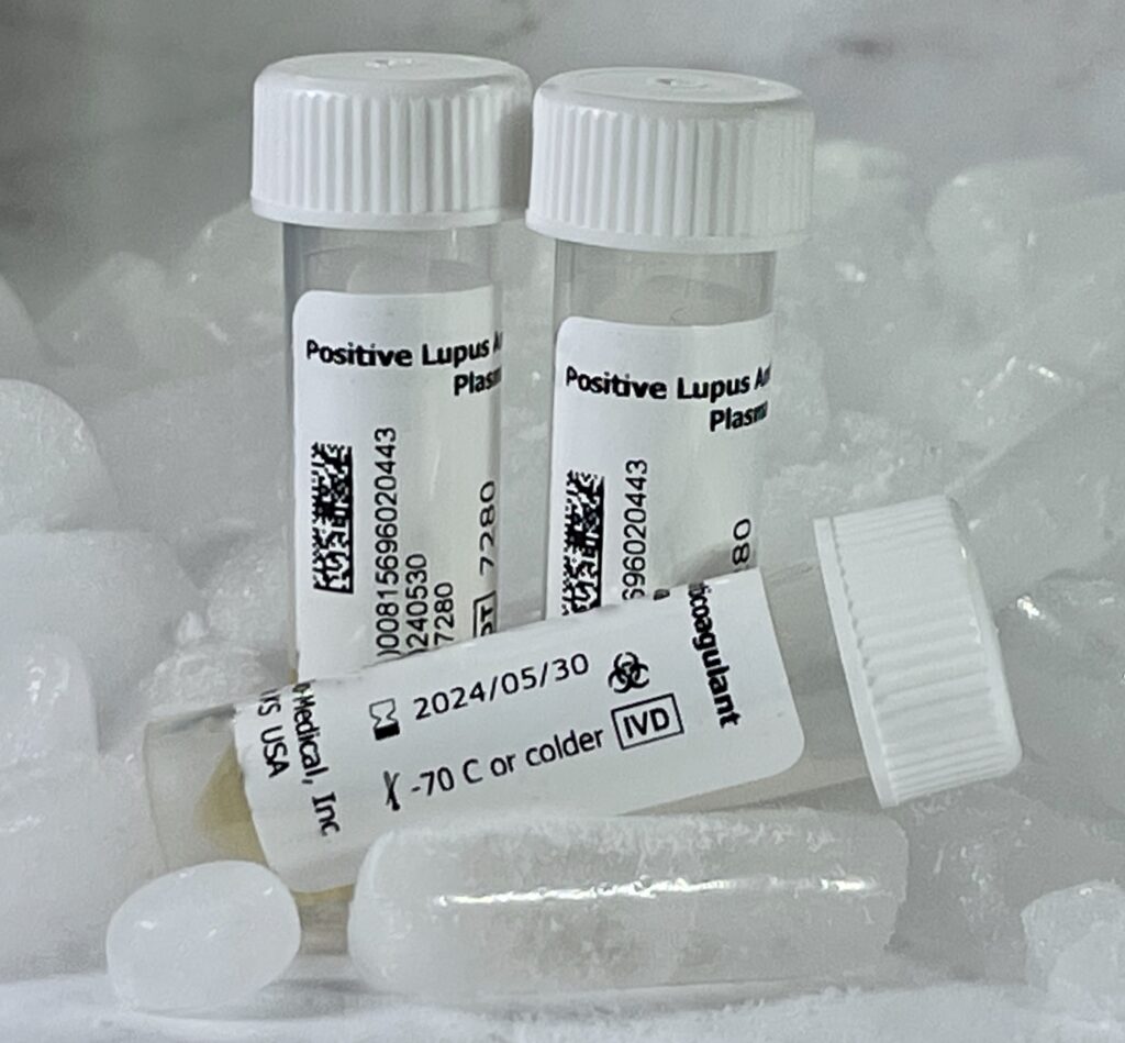 Positive Lupus Anticoagulant Plasma King BioMedical, Inc