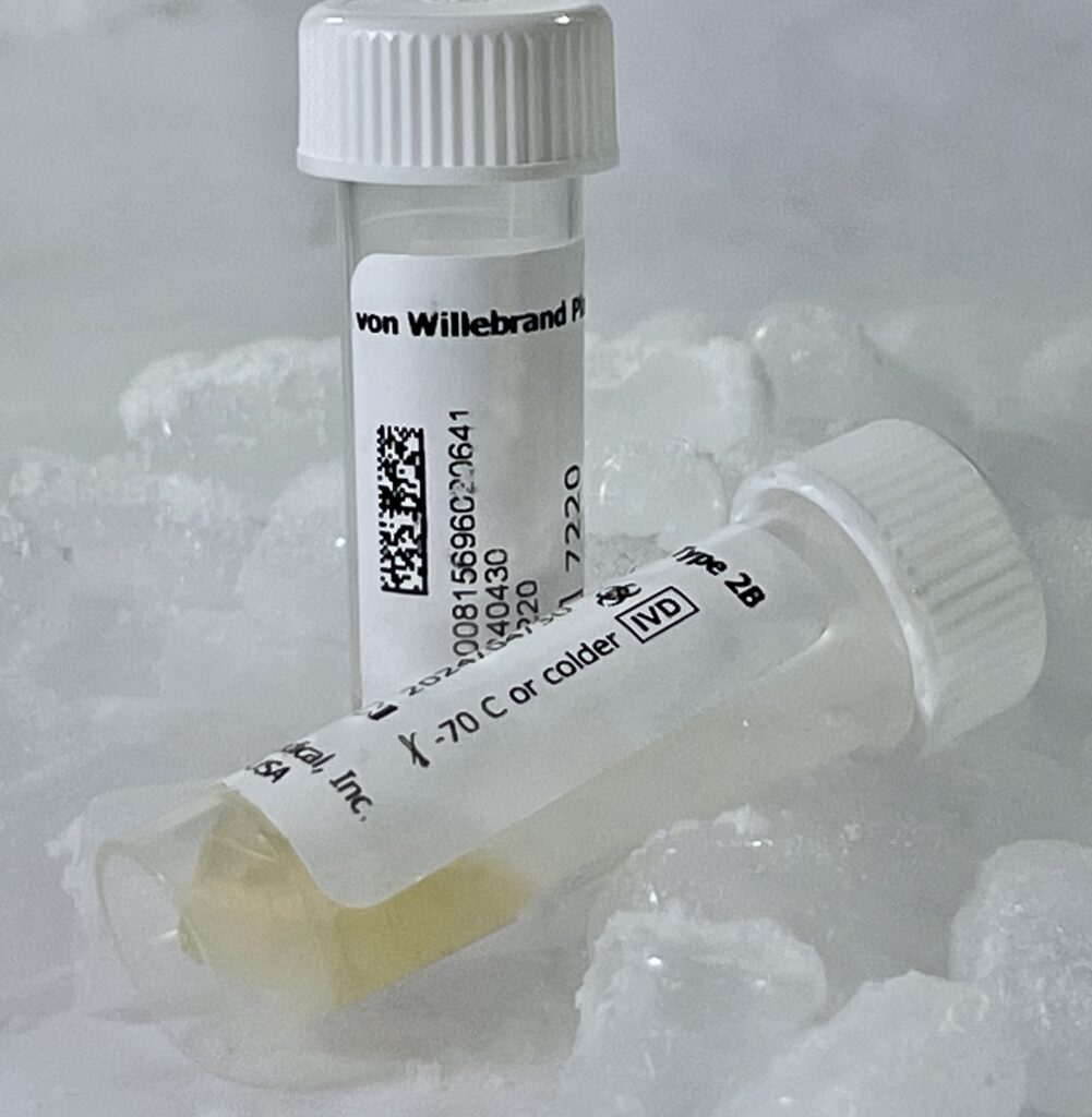 von Willebrand Plasma Type 2 (2B) King BioMedical, King BioMedical, Inc.